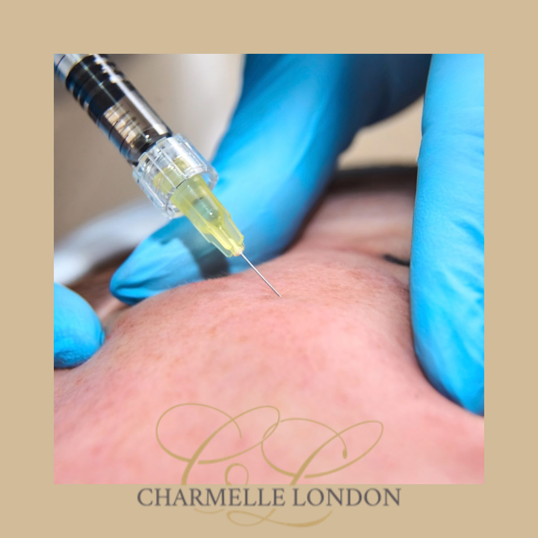 Experience emboldened confidence after receiving a skin boosting enhancement at Charmelle London. Enhance your appearance with a service dedicated to you, administered safely by experts.

With skin boosters you can rejuvenate your appearence to reveal a fresher looking you, plump fine lines and hydrate your skin.

Skin boosters are a versatile treatment option and are suitable for anyone looking to hydrate, plump and smooth their skin