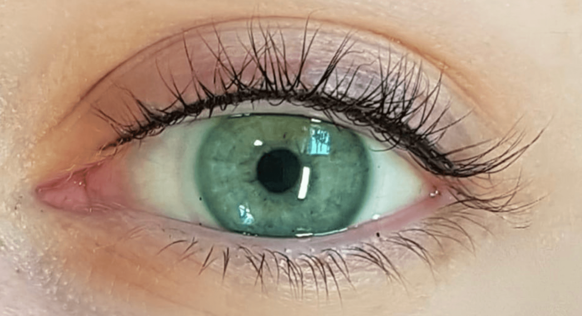 Eyelash Enhancement