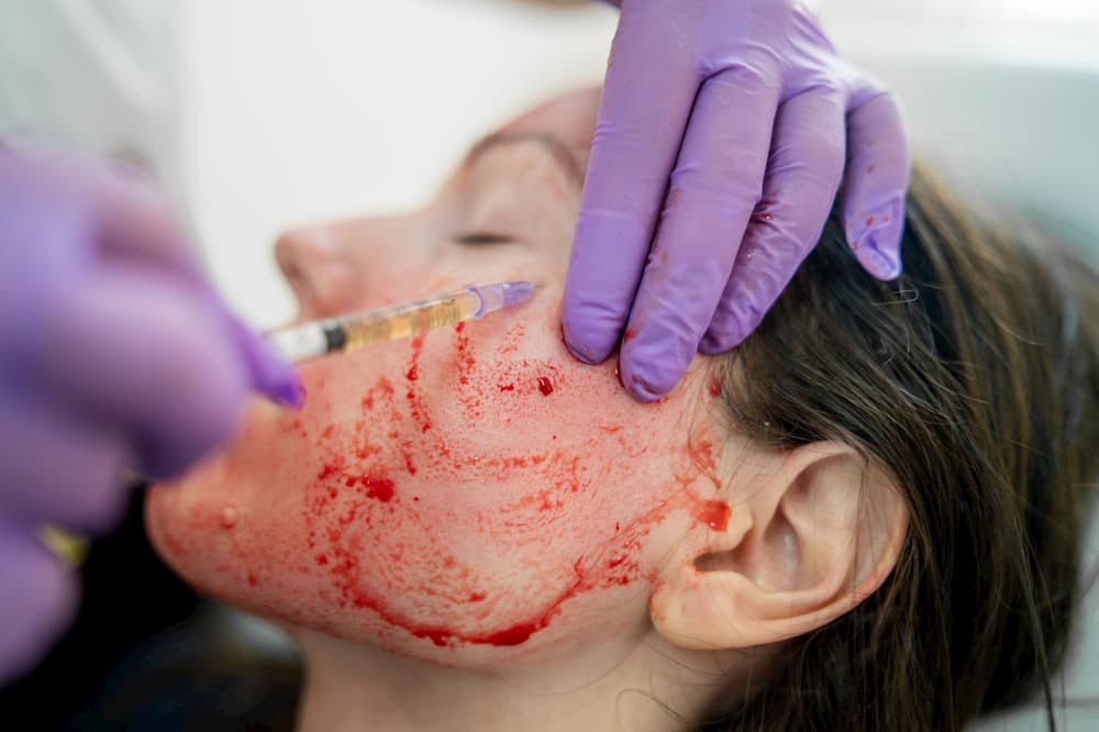 Dracula Skin Therapy