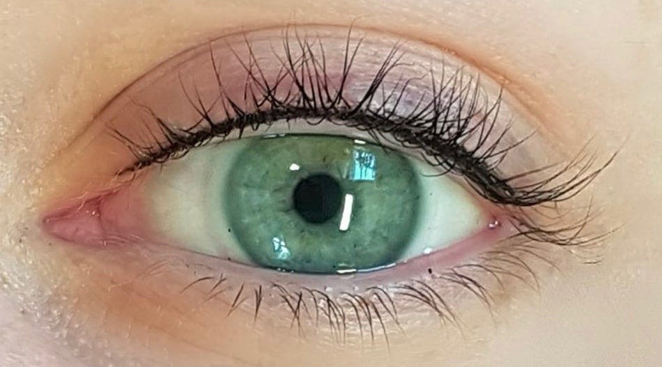 Eyelash Enhancement