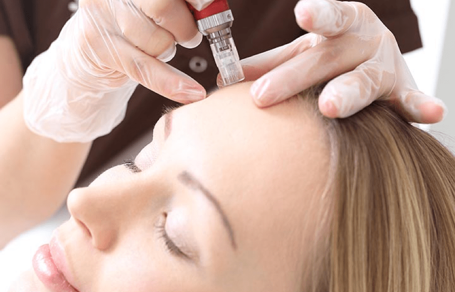 Mesotherapy Infusion