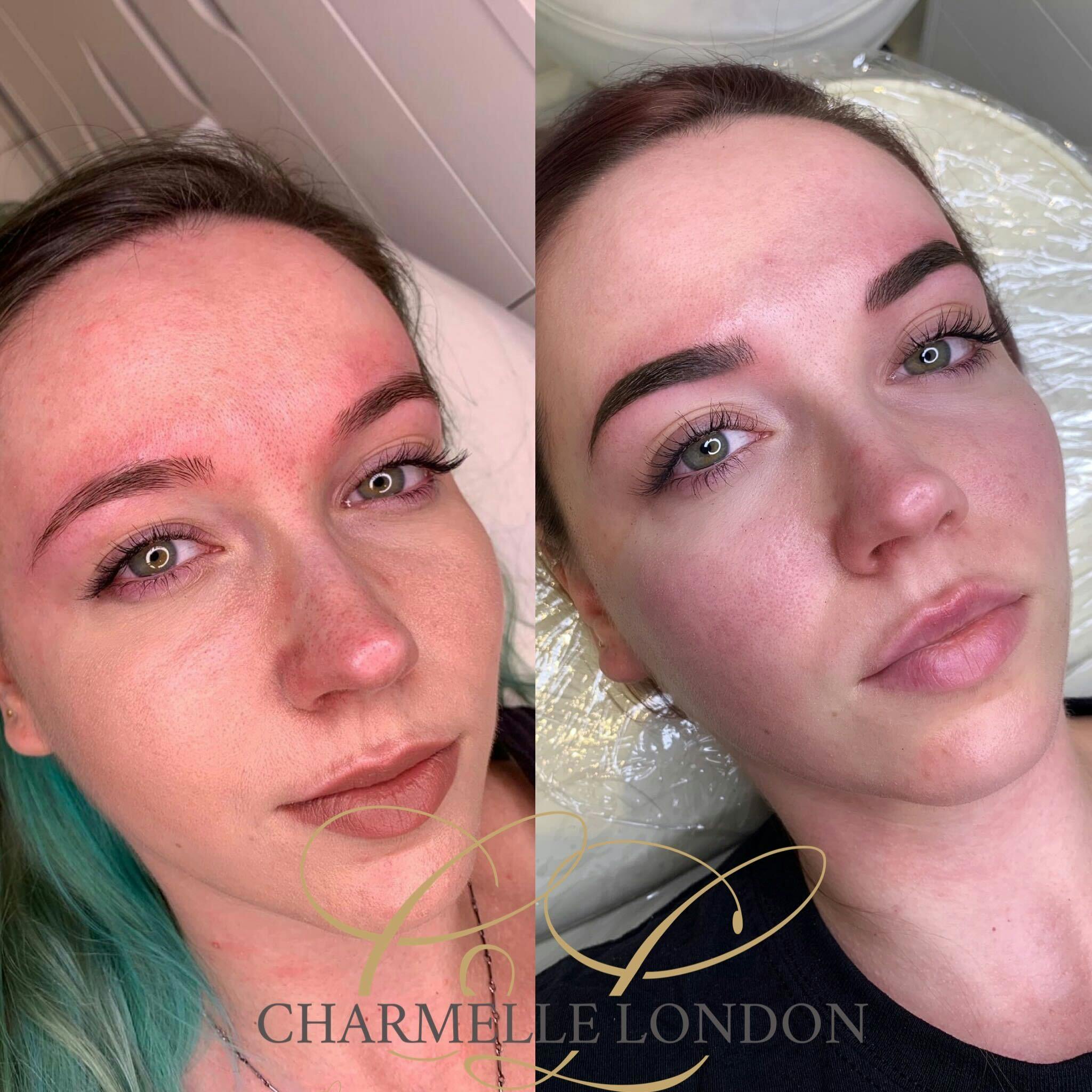 The team at Charmelle London has many years of experience and have delivered new looks for hundreds of clients.

We deliver permanent makeup services across brows, eyes and lips unique to your features.

Whether you are looking for something soft and natural or to create more of a statement look, we use the best products and techniques available to create truly bespoke and utterly flawless results for our clients