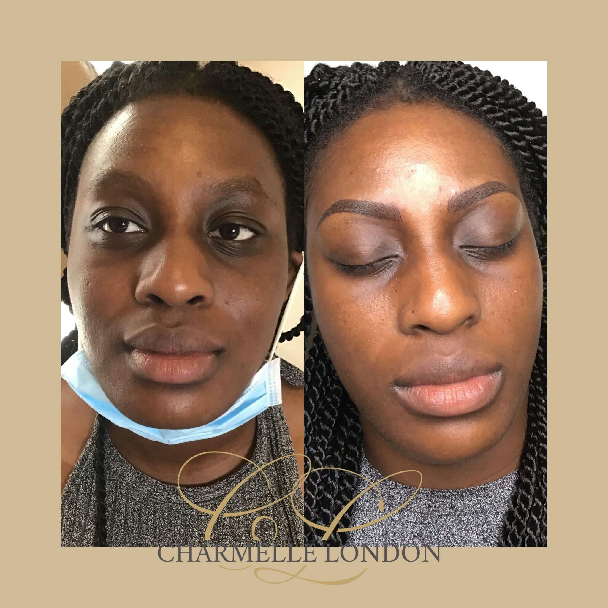 The team at Charmelle London has many years of experience and have delivered new looks for hundreds of clients.

We deliver permanent makeup services across brows, eyes and lips unique to your features.

Whether you are looking for something soft and natural or to create more of a statement look, we use the best products and techniques available to create truly bespoke and utterly flawless results for our clients